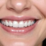 Glow-Up Your Smile: The High-Tech Magic Behind Modern Dental Crowns