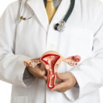 managing fibroids